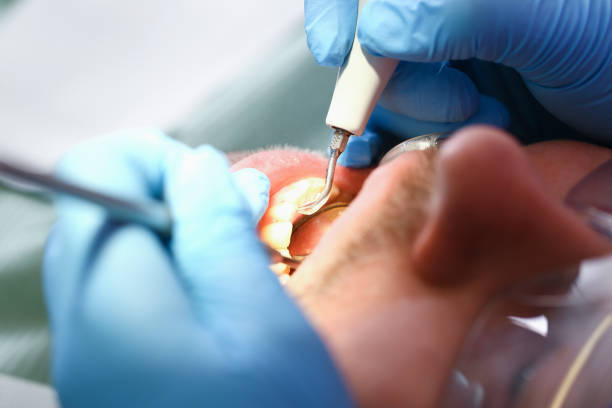 Best Emergency TMJ Treatment in Humboldt, IA